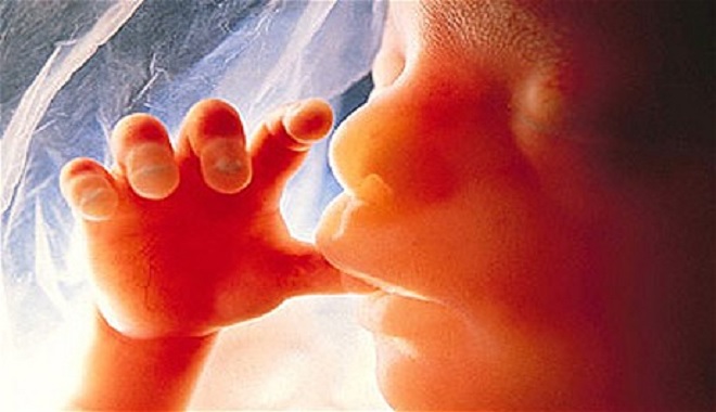 What is the truth about abortion today? | PEMPTOUSIA