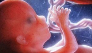 Abortions, the Church and Low Birth Rate